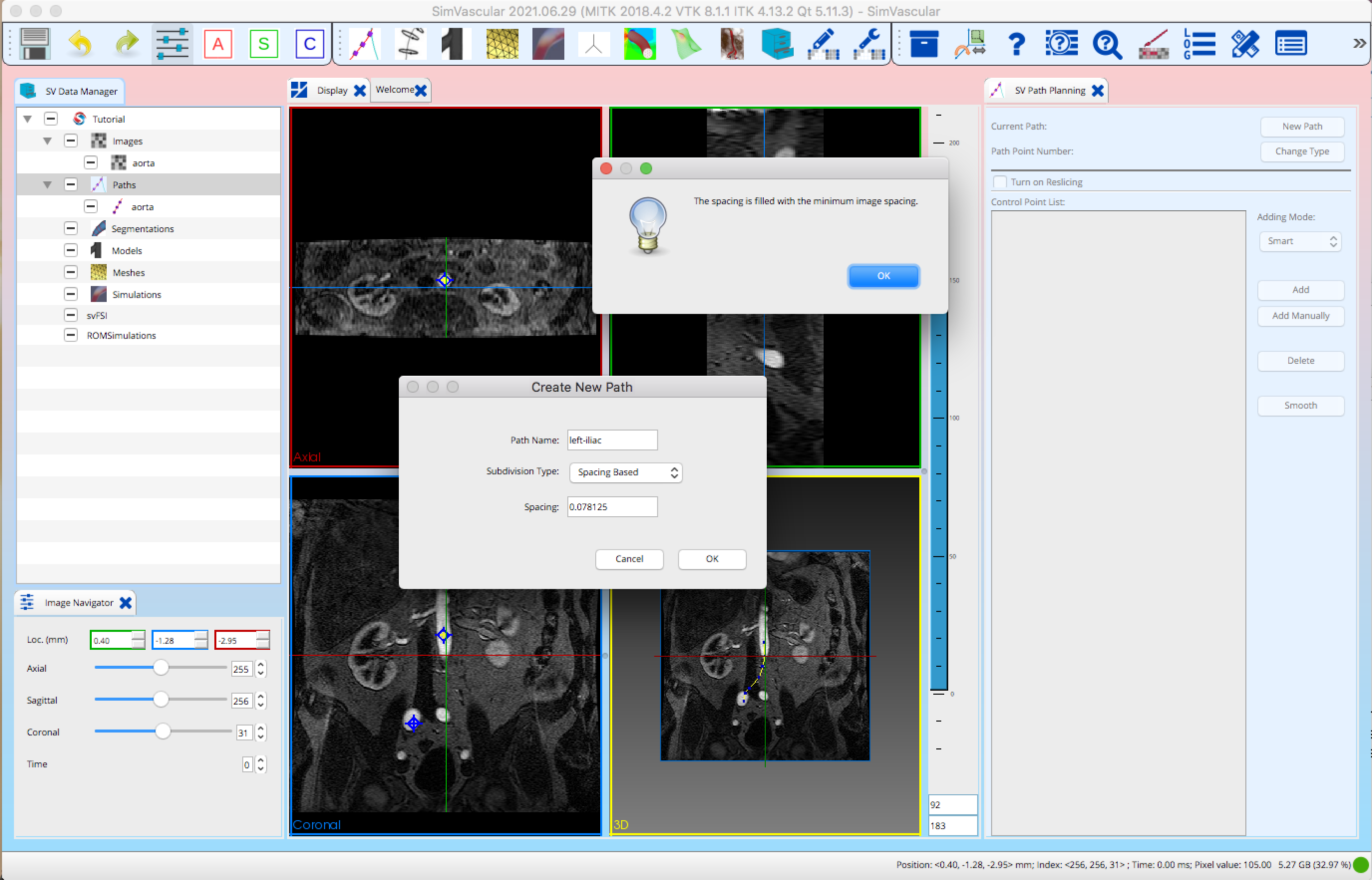 SimVascular Docs